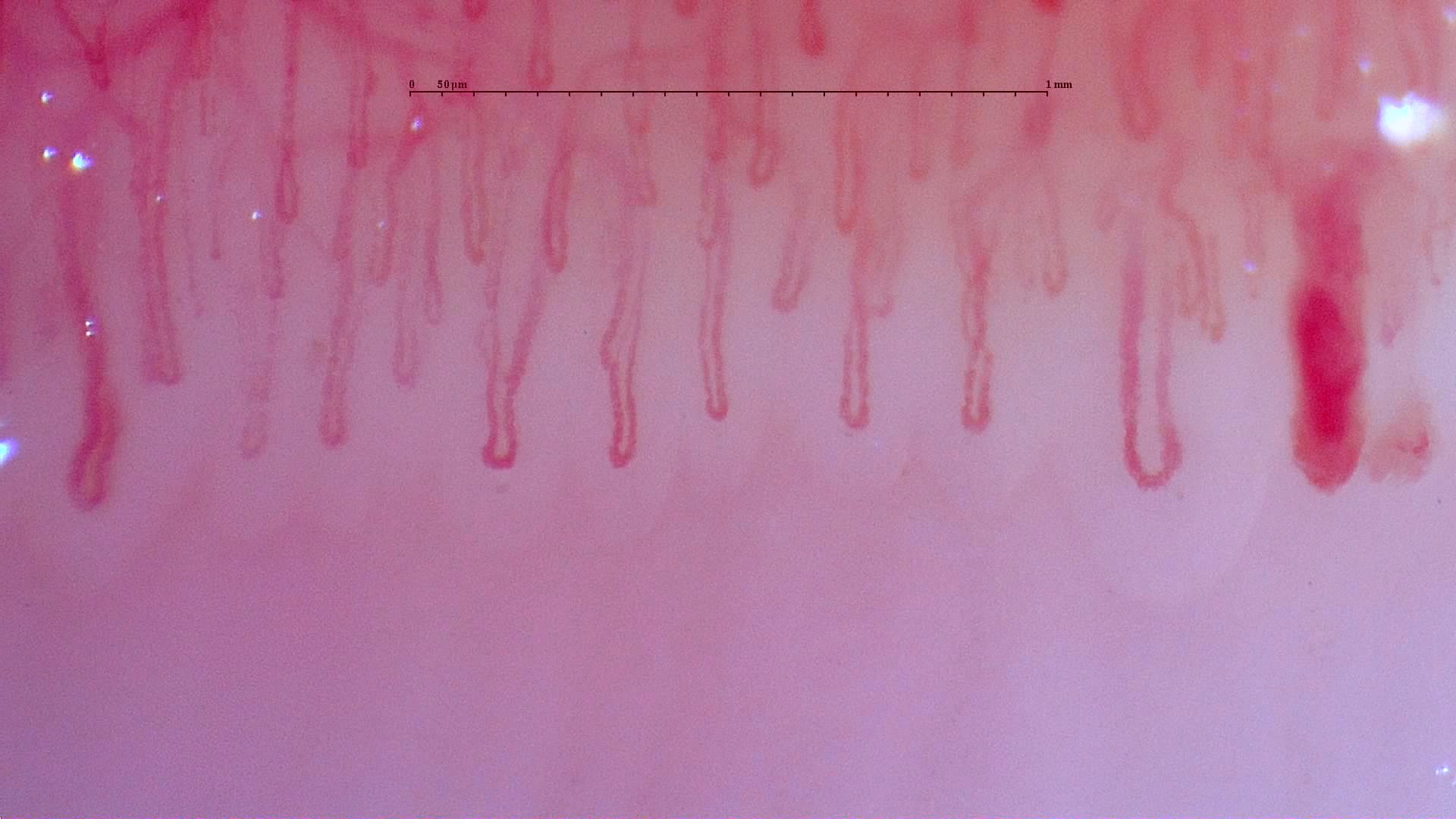 Capilaroscopia - ejemplo 1